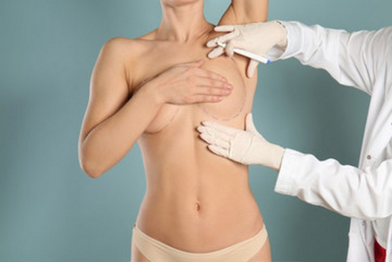 Cirurgia de Redução de Seio Preço Estrela - Cirurgia Mamoplastia Redutora