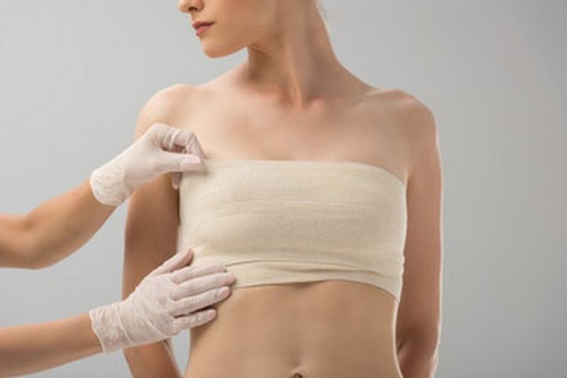 Cirurgia de Redução e Levantamento de Mama Calçoene - Cirurgia Mamoplastia Redutora