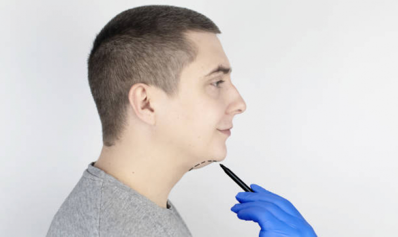 Lipoaspiração Masculina Valor Nova Olinda - Lipoaspiração e Abdominoplastia