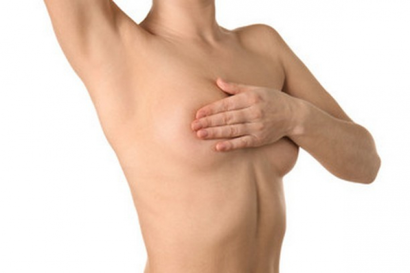 Preço de Cirurgia de Redução de Peito Barreiro - Cirurgia Mamoplastia Redutora