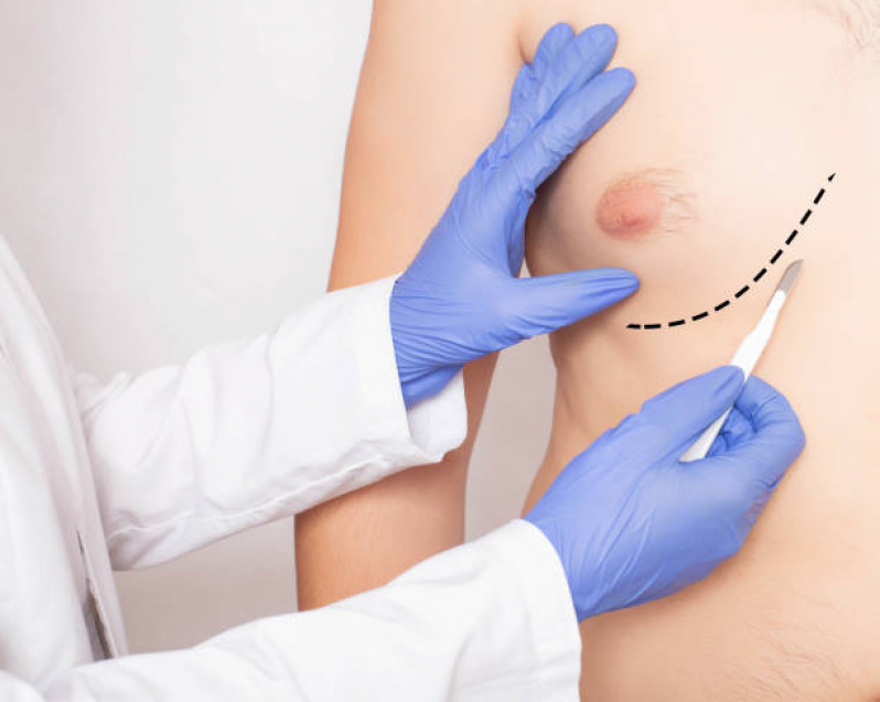Cirurgias de abdominoplastia