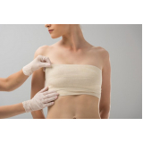 cirurgia de redução e levantamento de mama Santa Lídia