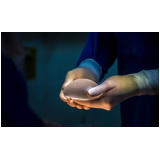 implante mamário texturizado preço Laranjal do Jari