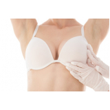 mamoplastia redutora com protese valores Rouxinol